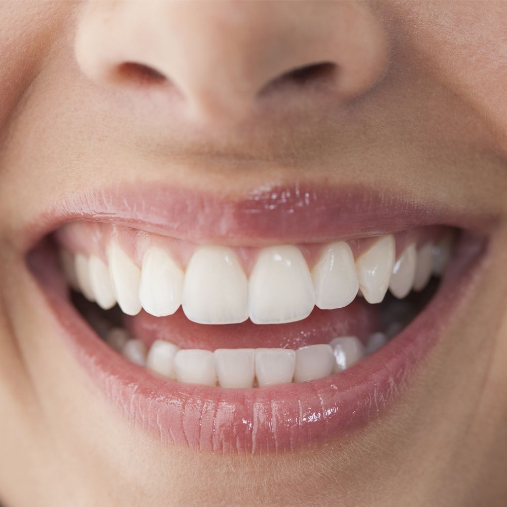 white-teeth-naturally